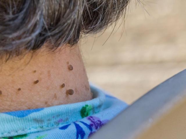 Résistance à l’insuline : comment comprendre pour mieux prévenir ?